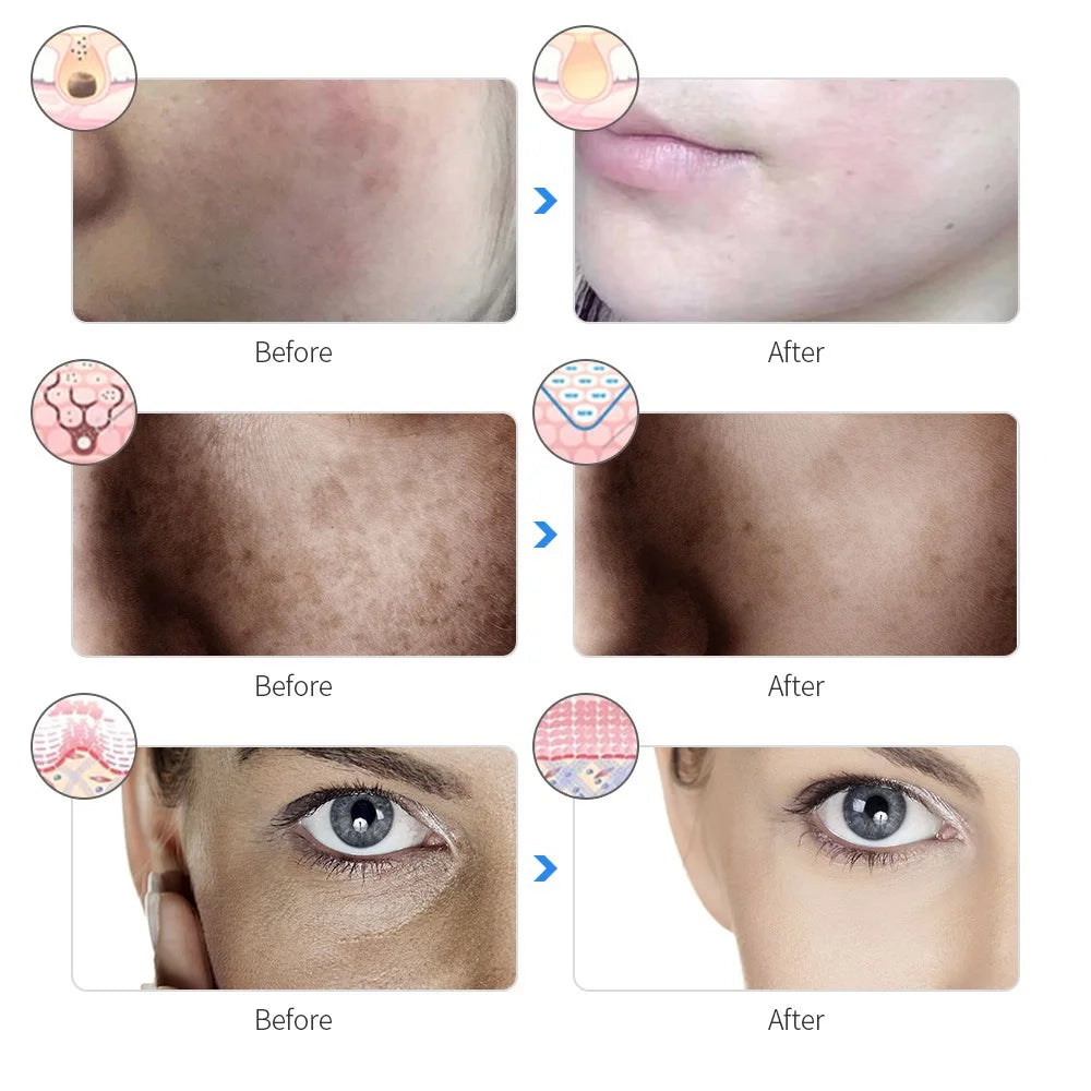 LumaGlow 7-Color LED Facial Mask